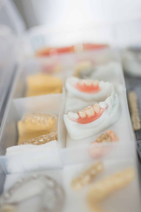 Quels types de prothèses dentaires sont disponibles au Centre dentaire GK ?